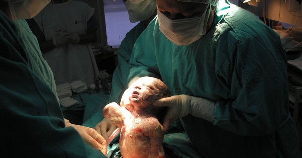 דימום לאחר לידה: תביעת הפיצויים בגובה 7.5 מיליון שקלים