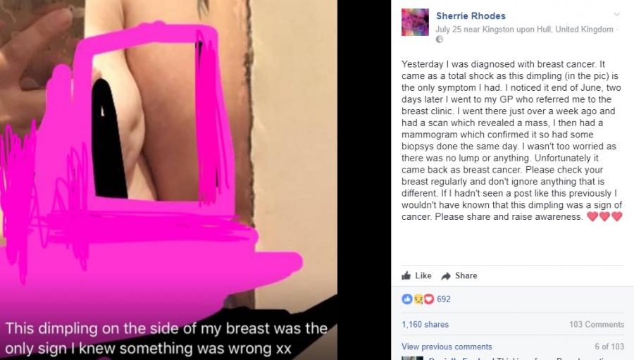 העלתה פוסט לפייסבוק אחרי שחולה בסרטן השד