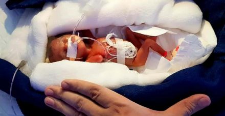 התינוקת הקטנה ביותר שנולדה באסיה משתחררת מבית החולים