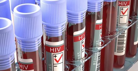 התקדמות הטיפול התרופתי ב-HIV – האם אנחנו קרובים למיגור המחלה?